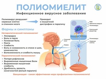РЕКОМЕНДАЦИИ ГРАЖДАНАМ: Профилактика полиомиелита